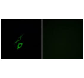 Immunofluorescence - Anti-FPR1 Antibody (G251) - Antibodies.com