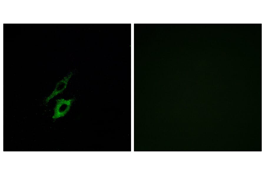 Immunofluorescence - Anti-FPR1 Antibody (G251) - Antibodies.com
