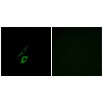 Immunofluorescence - Anti-FPR1 Antibody (G251) - Antibodies.com