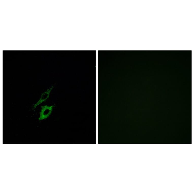 Immunofluorescence - Anti-FPR1 Antibody (G251) - Antibodies.com
