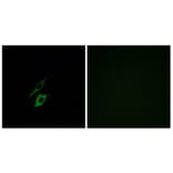 Immunofluorescence - Anti-FPR1 Antibody (G251) - Antibodies.com