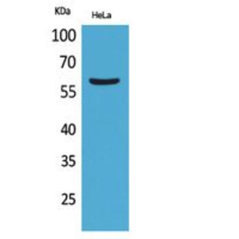 Western Blot - Anti-FMO3 Antibody (C30287) - Antibodies.com