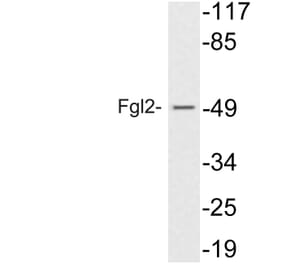 Western Blot - Anti-Fgl2 Antibody (R12-2142) - Antibodies.com