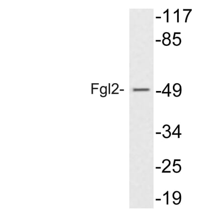 Western Blot - Anti-Fgl2 Antibody (R12-2142) - Antibodies.com