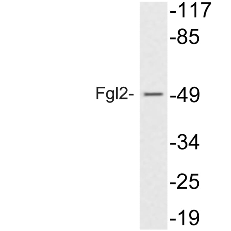 Western Blot - Anti-Fgl2 Antibody (R12-2142) - Antibodies.com