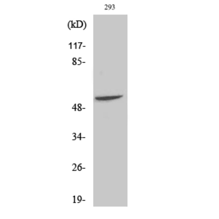 Western Blot - Anti-Fgl2 Antibody (R12-2142) - Antibodies.com