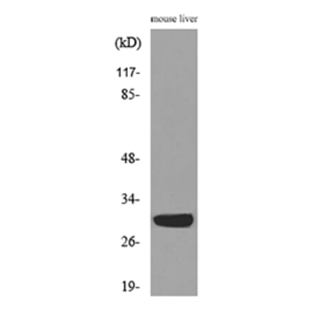 Western Blot - Anti-FGF5 Antibody (C30117) - Antibodies.com