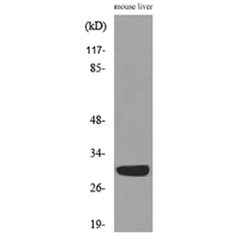 Western Blot - Anti-FGF5 Antibody (C30117) - Antibodies.com