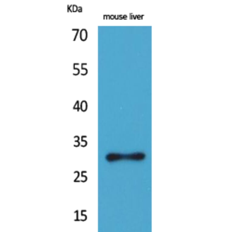 Western Blot - Anti-FGF5 Antibody (C30117) - Antibodies.com