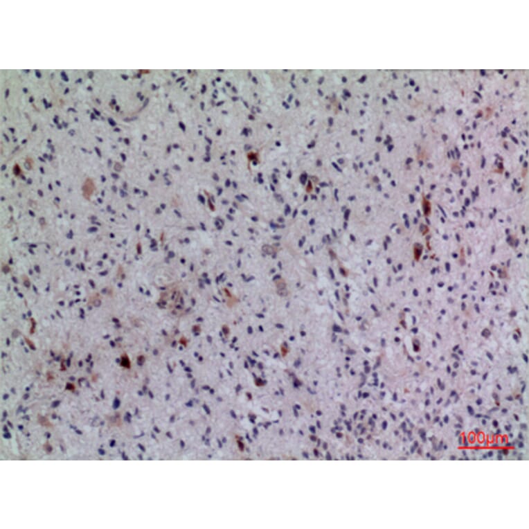 Immunohistochemistry - Anti-FGF5 Antibody (C30117) - Antibodies.com