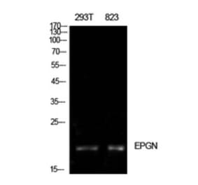 Western Blot - Anti-EPGN Antibody (C30728) - Antibodies.com