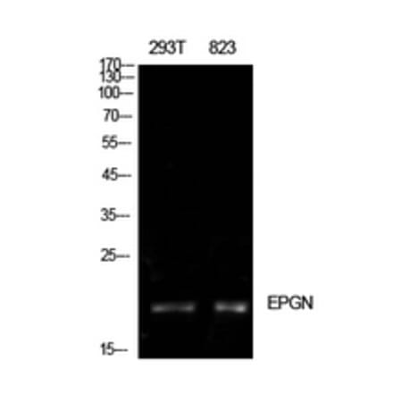 Western Blot - Anti-EPGN Antibody (C30728) - Antibodies.com