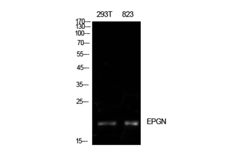 Western Blot - Anti-EPGN Antibody (C30728) - Antibodies.com