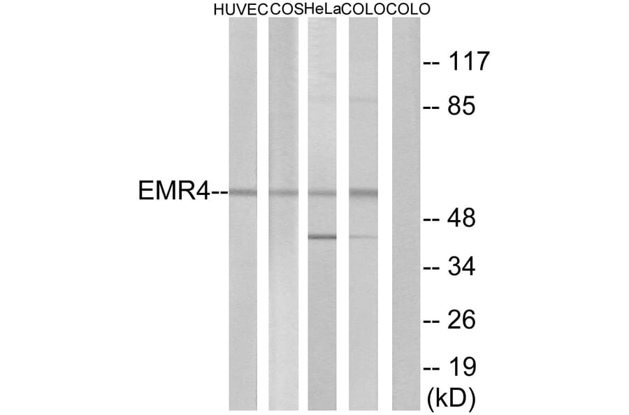 Western Blot - Anti-EMR4 Antibody (G246) - Antibodies.com