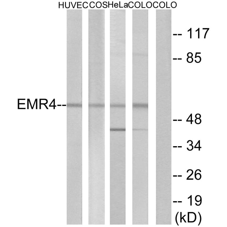 Western Blot - Anti-EMR4 Antibody (G246) - Antibodies.com