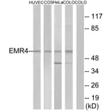 Western Blot - Anti-EMR4 Antibody (G246) - Antibodies.com