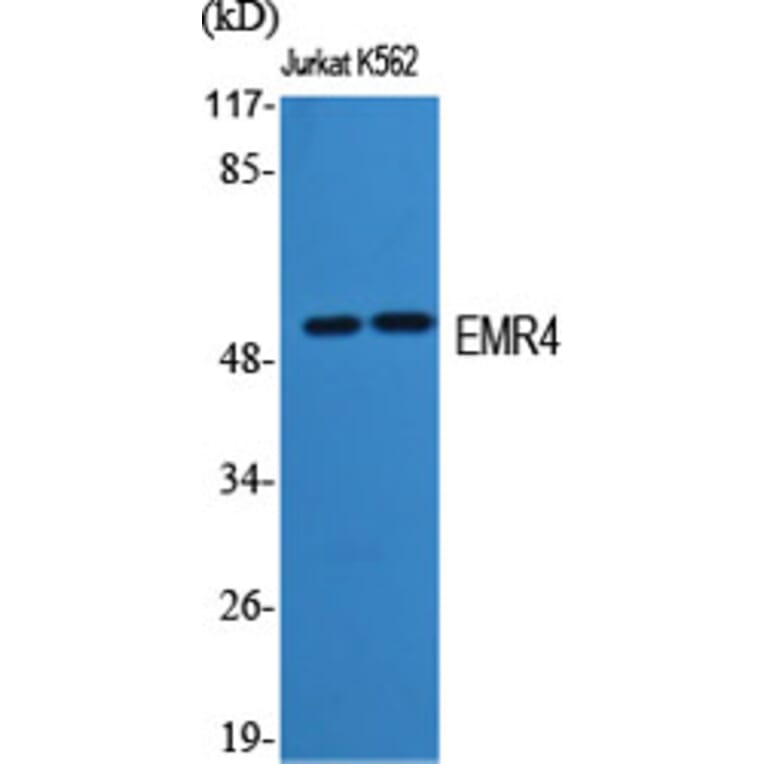 Western Blot - Anti-EMR4 Antibody (G246) - Antibodies.com
