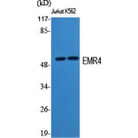Western Blot - Anti-EMR4 Antibody (G246) - Antibodies.com