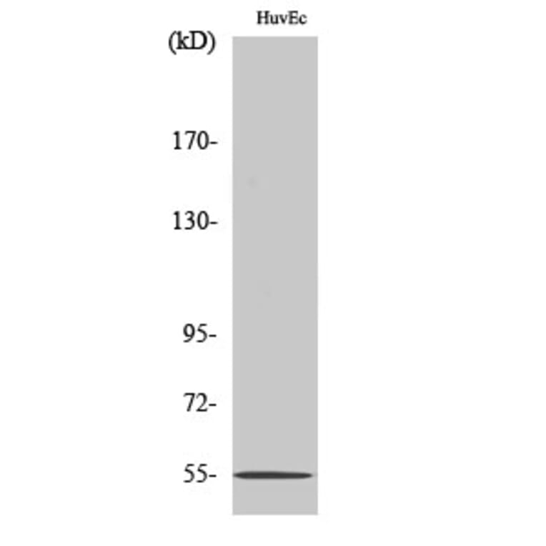 Western Blot - Anti-EMR4 Antibody (G246) - Antibodies.com