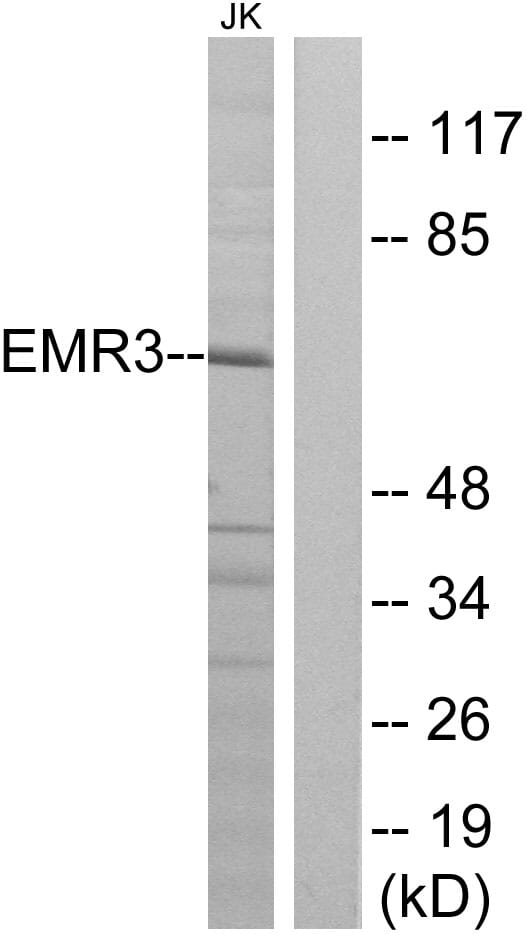 Western blot analysis of lysates from Jurkat cells using Anti-EMR3 Antibody. The right hand lane represents a negative control, where the antibody is blocked by the immunising peptide.