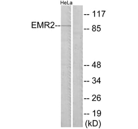 Western Blot - Anti-EMR2 Antibody (G244) - Antibodies.com