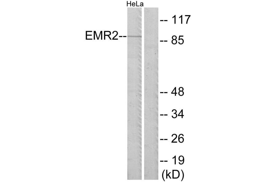 Western Blot - Anti-EMR2 Antibody (G244) - Antibodies.com