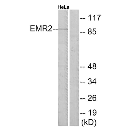 Western Blot - Anti-EMR2 Antibody (G244) - Antibodies.com