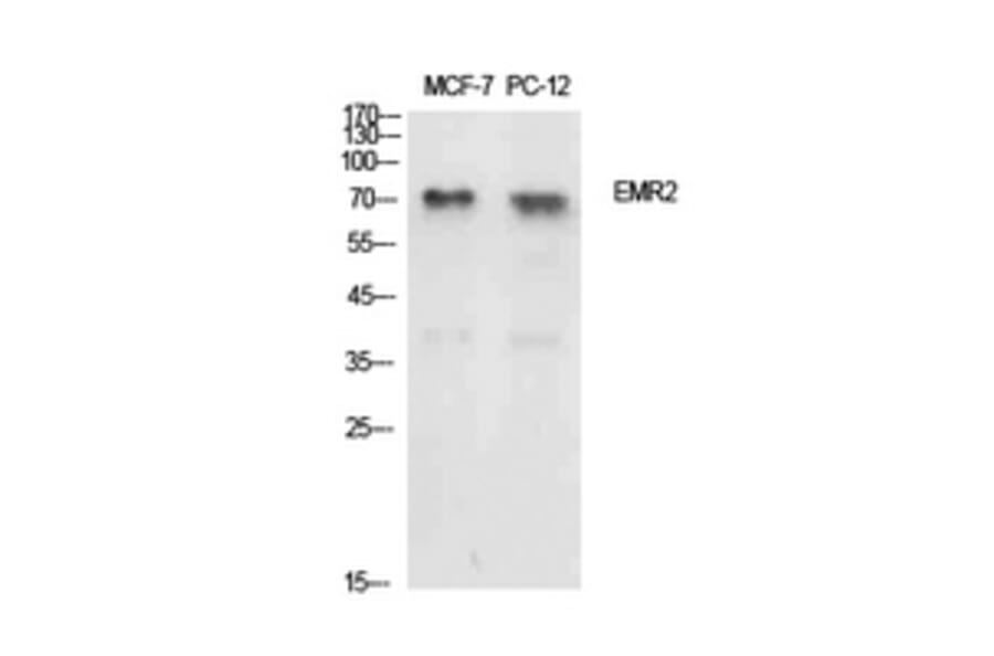 Western Blot - Anti-EMR2 Antibody (C30508) - Antibodies.com