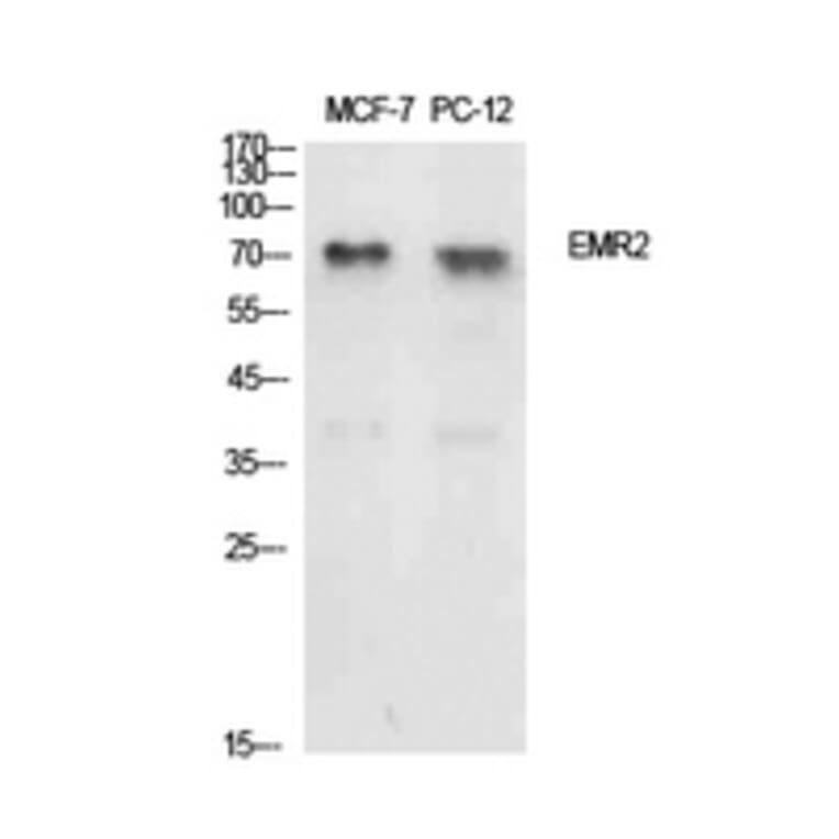 Western Blot - Anti-EMR2 Antibody (C30508) - Antibodies.com