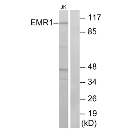 Western Blot - Anti-EMR1 Antibody (G090) - Antibodies.com