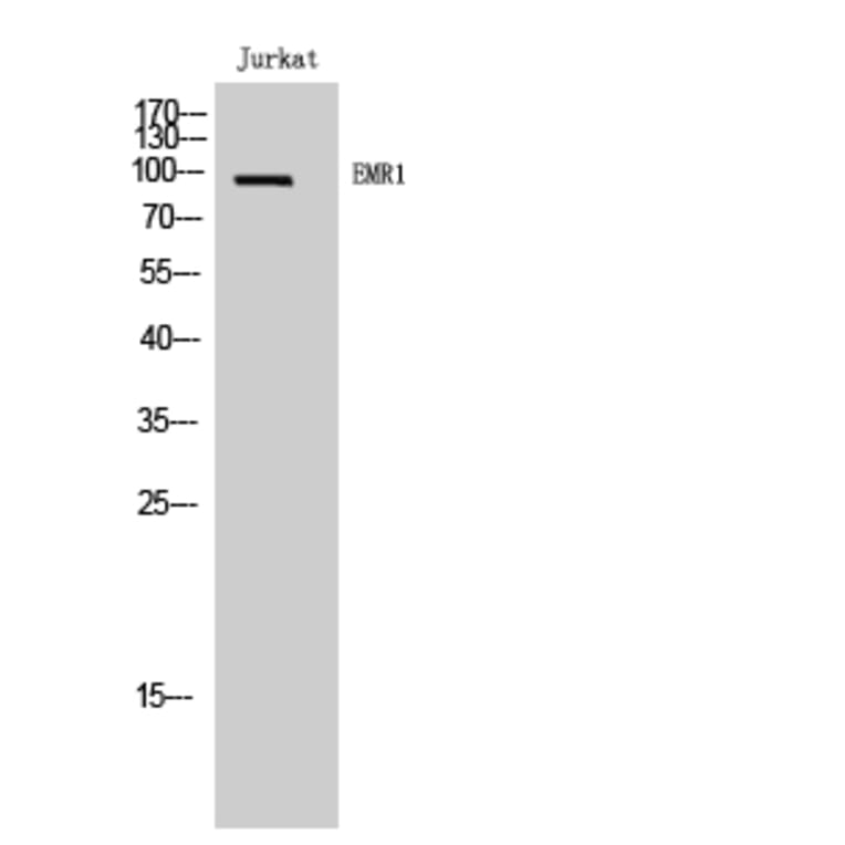 Western Blot - Anti-EMR1 Antibody (G090) - Antibodies.com