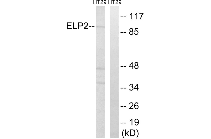 Western Blot - Anti-ELP2 Antibody (C15624) - Antibodies.com