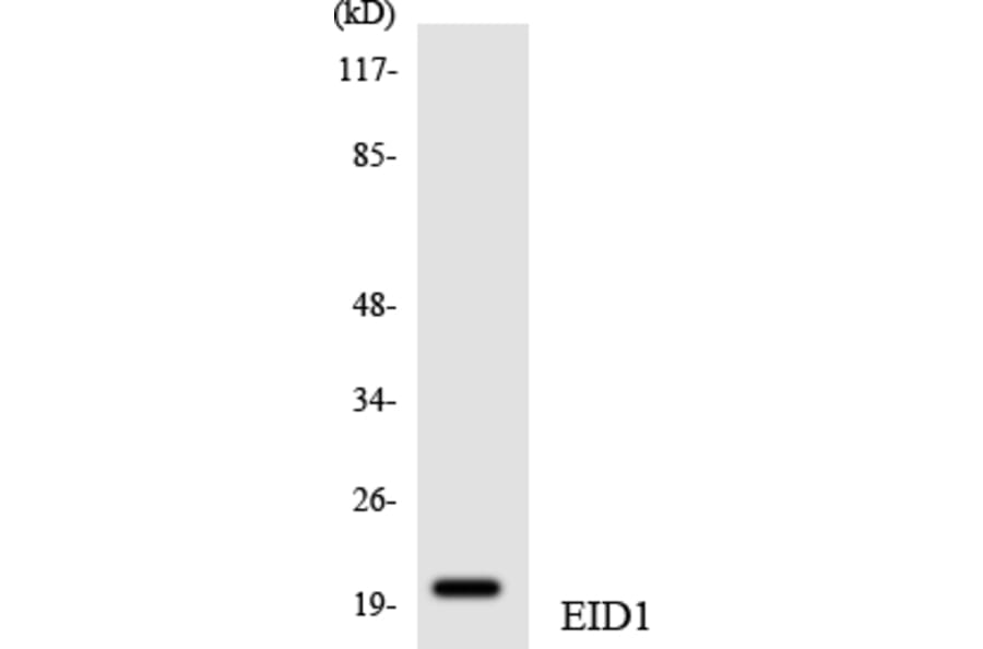 Western Blot - Anti-EID1 Antibody (R12-2738) - Antibodies.com
