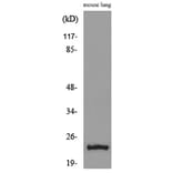 Western Blot - Anti-EDN1 Antibody (C30019) - Antibodies.com