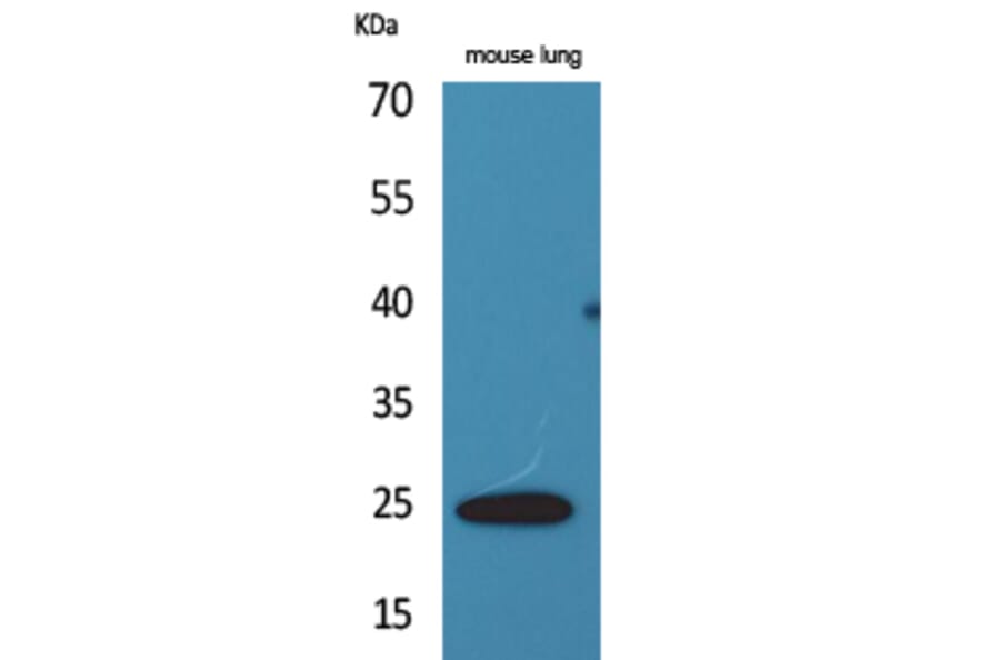 Western Blot - Anti-EDN1 Antibody (C30019) - Antibodies.com