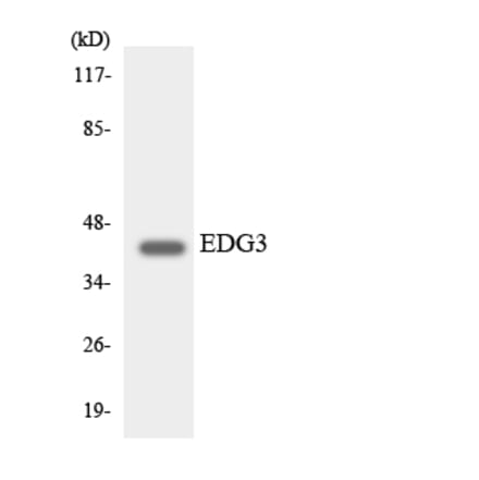 Western Blot - Anti-EDG3 Antibody (R12-2721) - Antibodies.com