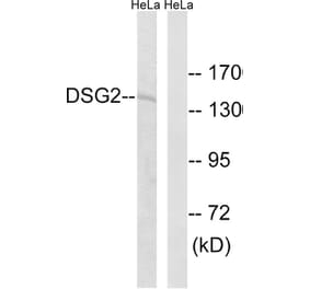 Western Blot - Anti-DSG2 Antibody (C15333) - Antibodies.com