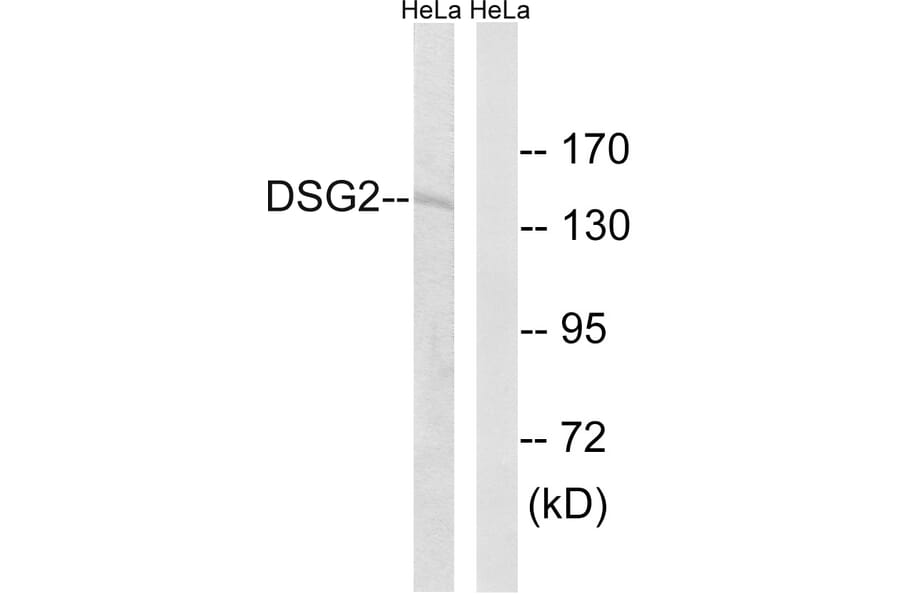 Western Blot - Anti-DSG2 Antibody (C15333) - Antibodies.com