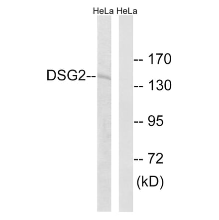 Western Blot - Anti-DSG2 Antibody (C15333) - Antibodies.com