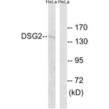 Western Blot - Anti-DSG2 Antibody (C15333) - Antibodies.com