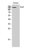 Western Blot - Anti-DSG2 Antibody (C15333) - Antibodies.com