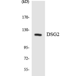 Western Blot - Anti-DSG2 Antibody (R12-2716) - Antibodies.com