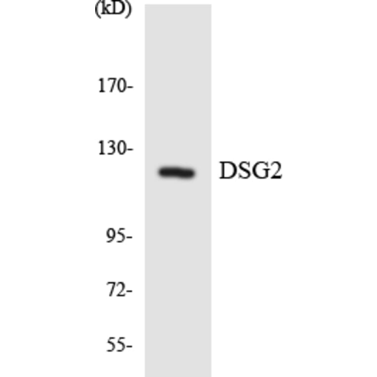 Western Blot - Anti-DSG2 Antibody (R12-2716) - Antibodies.com