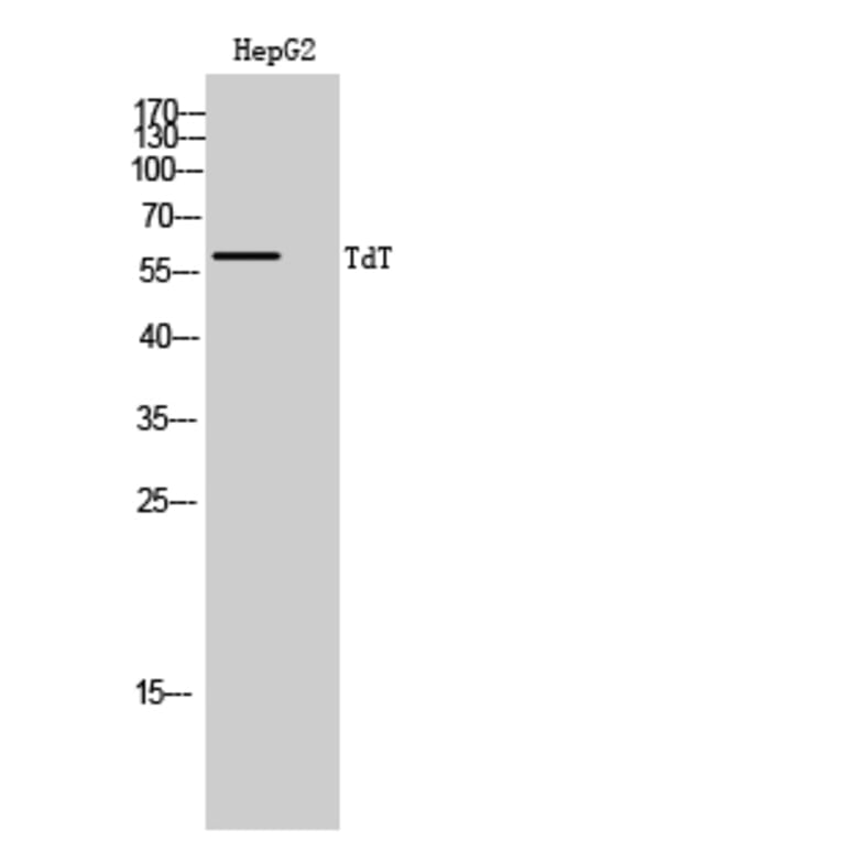 Western Blot - Anti-DNTT Antibody (C15389) - Antibodies.com