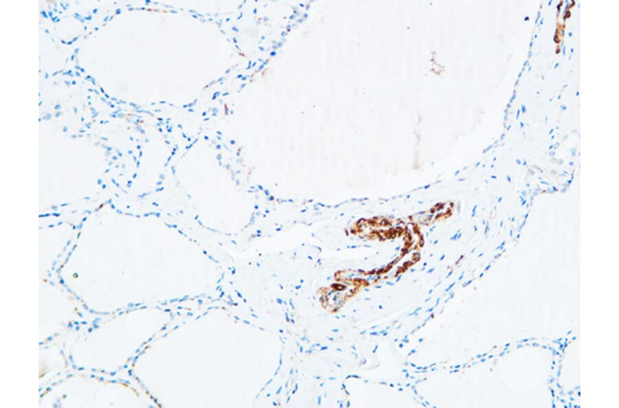 Immunohistochemistry - Anti-DNTT Antibody (C15389) - Antibodies.com