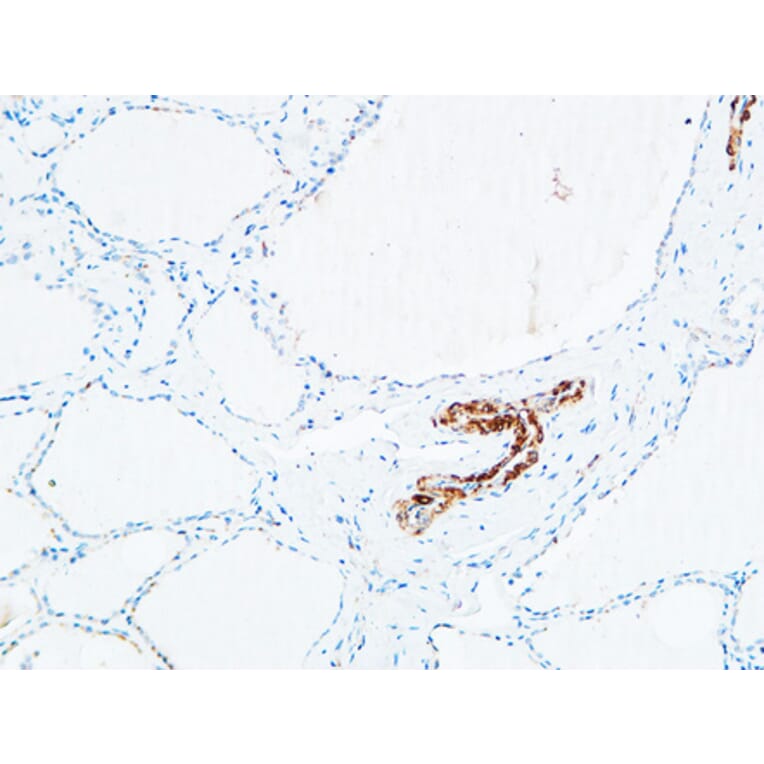 Immunohistochemistry - Anti-DNTT Antibody (C15389) - Antibodies.com