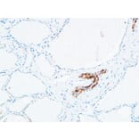 Immunohistochemistry - Anti-DNTT Antibody (C15389) - Antibodies.com