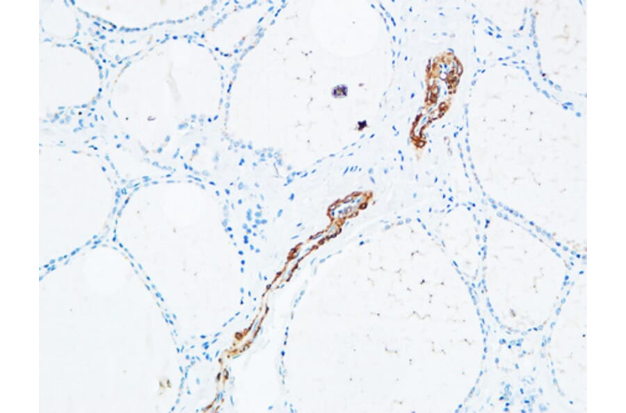 Immunohistochemistry - Anti-DNTT Antibody (C15389) - Antibodies.com