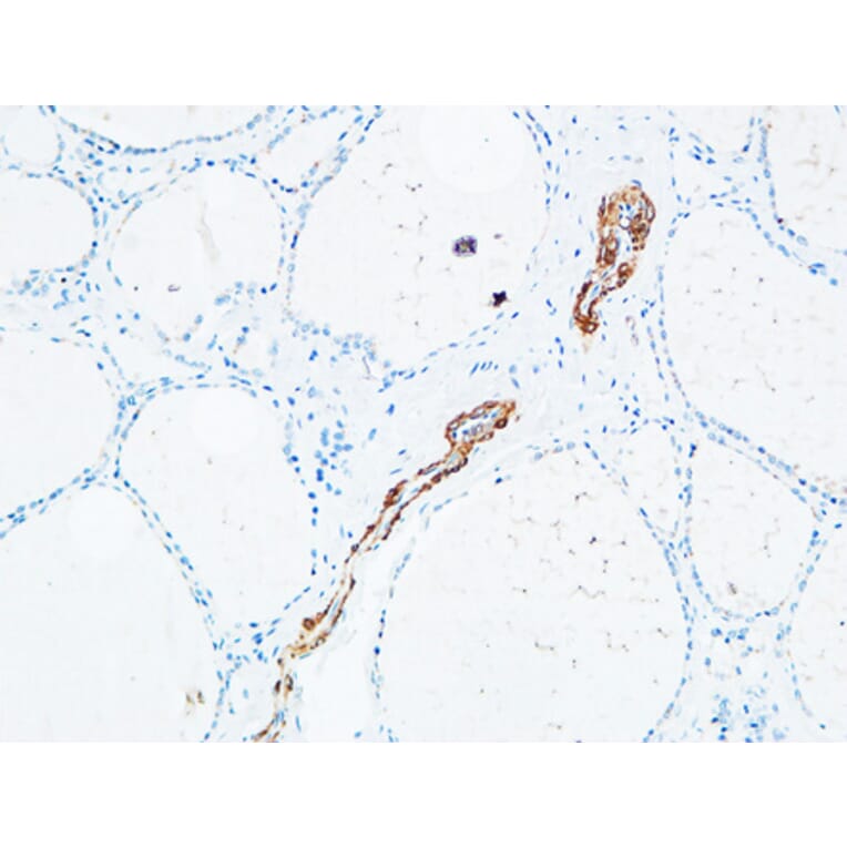 Immunohistochemistry - Anti-DNTT Antibody (C15389) - Antibodies.com