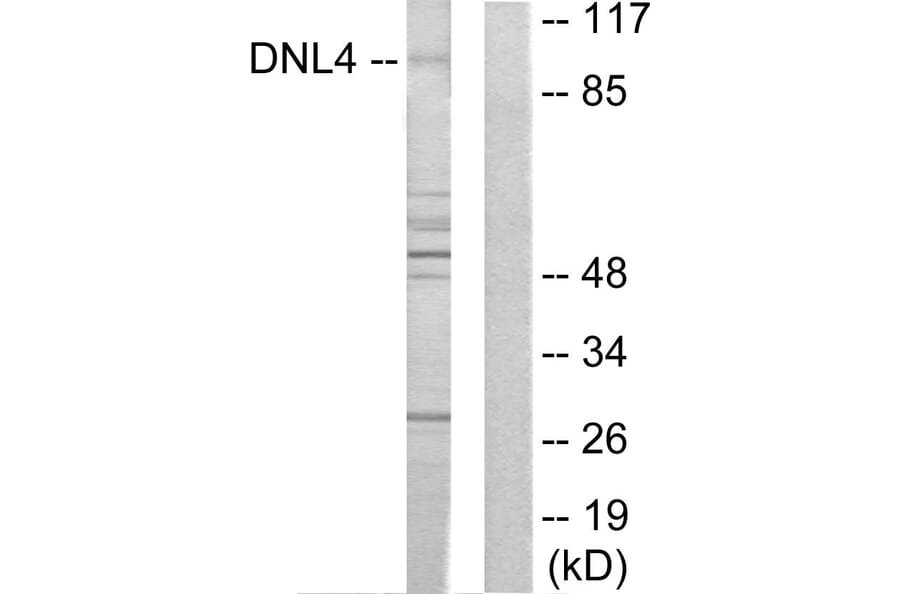 Western Blot - Anti-DNL4 Antibody (C13046) - Antibodies.com